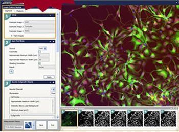 Molecular Devices Introduces MetaXpress 5.0 High Content Image Acquisition and Analysis Software