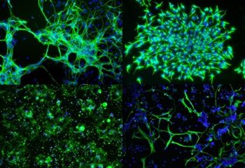 Highly Efficient Targeted mRNA Delivery