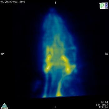 AXT Brings Magnetic Particle Imaging Technology to Australia