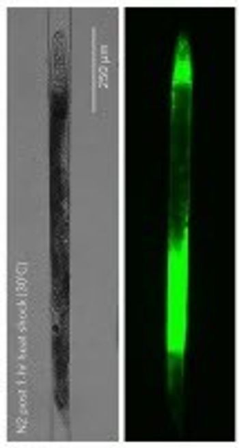 NemaMetrix Introduces Fluorescent Staining Kits for Improved Phenotyping in model organism C. elegans