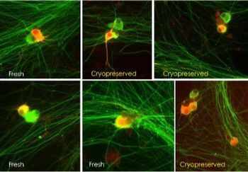 High-Quality Dorsal Root Ganglion Neurons for Research
