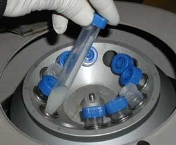 Centrifuge – The Instrument Found in Almost Every Lab