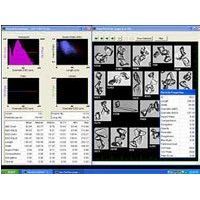 Fluid Imaging Technologies - VisualSpreadsheet