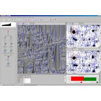 SYNGENE - 2D gel image analysis