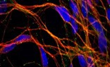 AMSbio - Human iPS Cell-Derived  Neural Progenitors & Neurons