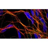AMSbio - Human iPS Cell-Derived  Neural Progenitors & Neurons