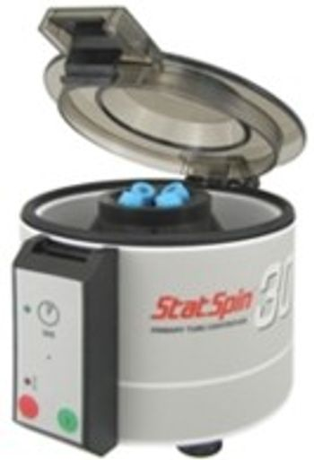 Iris Sample Processing - StatSpin 30